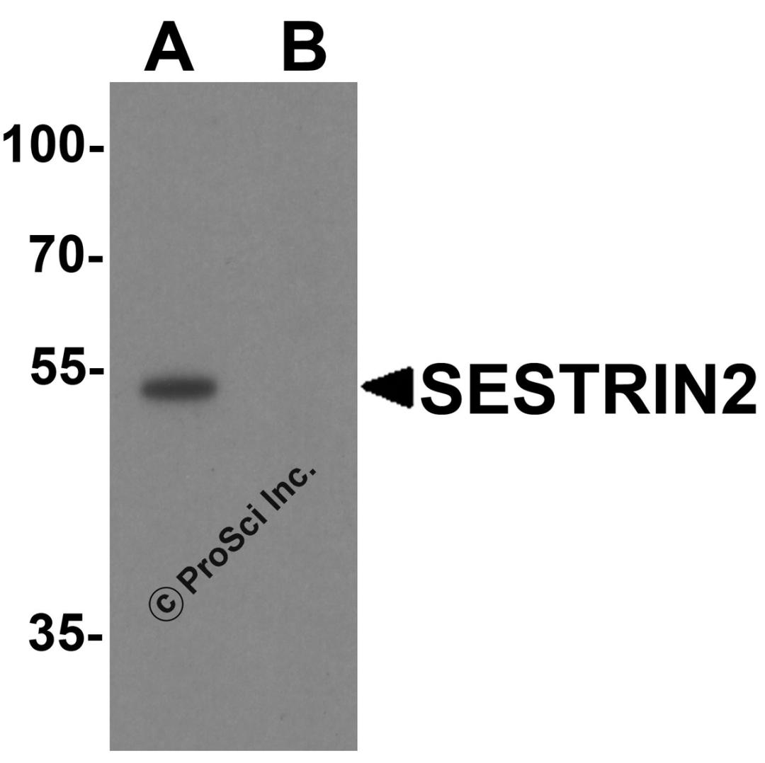 Western blot analysis of SESTRIN2 in mouse kidney tissue lysate with SESTRIN2 antibody at 1 μg/ml in (A) the absence and (B) the presence of blocking peptide.