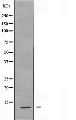 Western blot analysis of HUVEC cells using S100A7L2 antibody