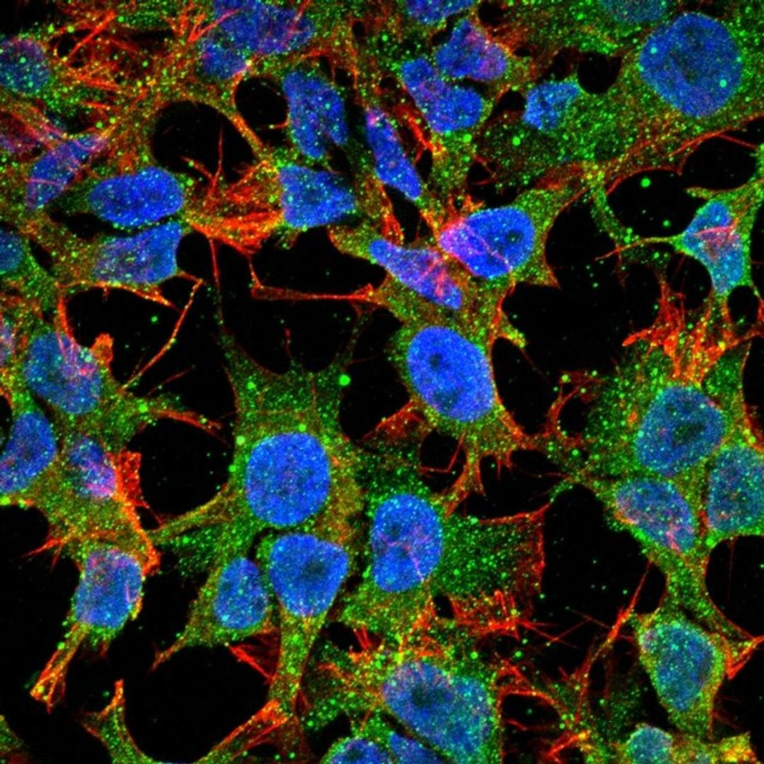 Immunofluorescence analysis of neuroblastoma cell line sk-n-be using Protocadherin Gamma C3 antibody