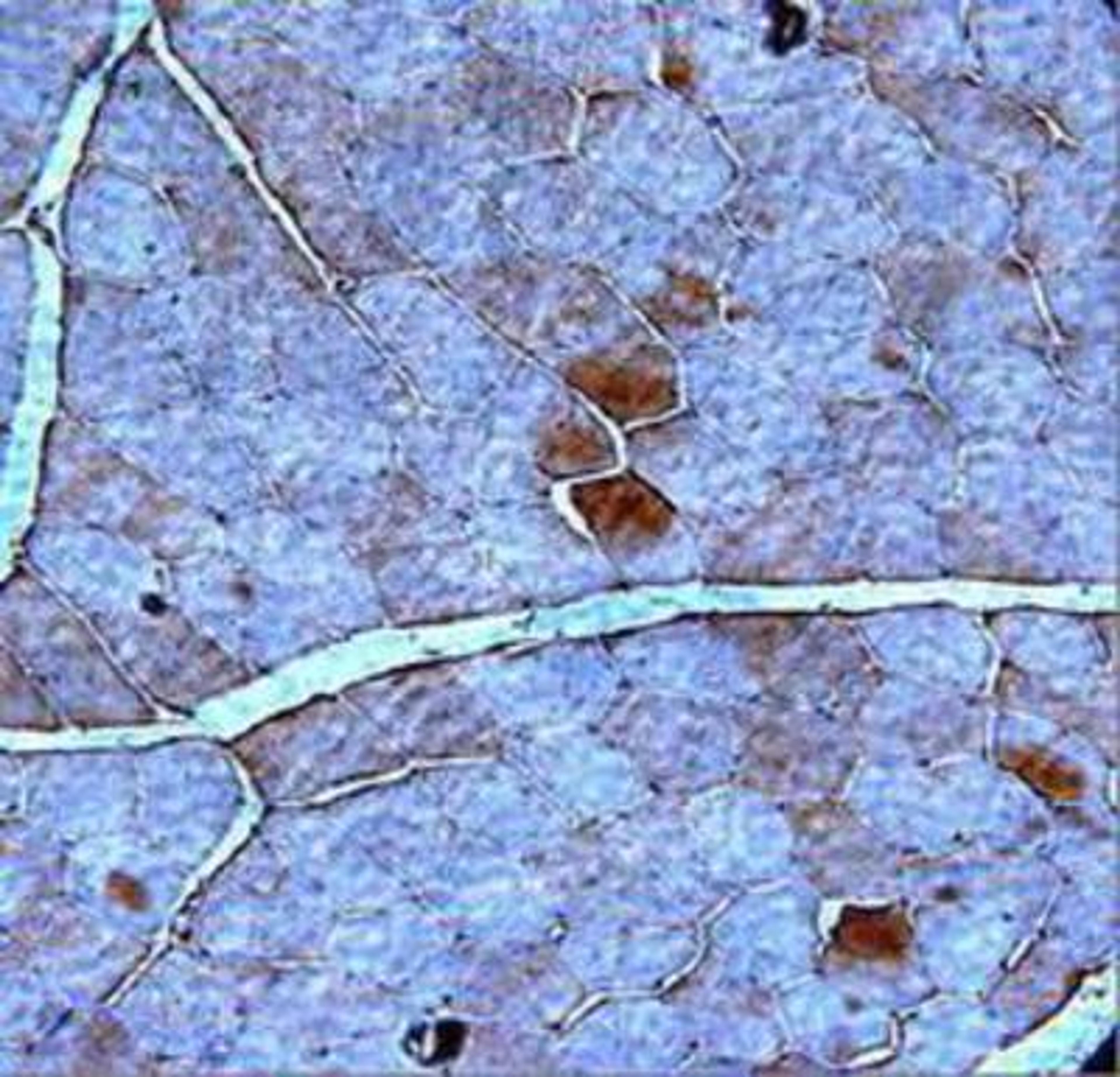 Immunohistochemistry-Paraffin: Adiponectin Receptor 2 Antibody [NBP1-47241] - paraffin section human muscle