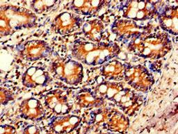 Immunohistochemistry of paraffin-embedded human small intestine tissue using CSB-PA06719A0Rb at dilution of 1:100