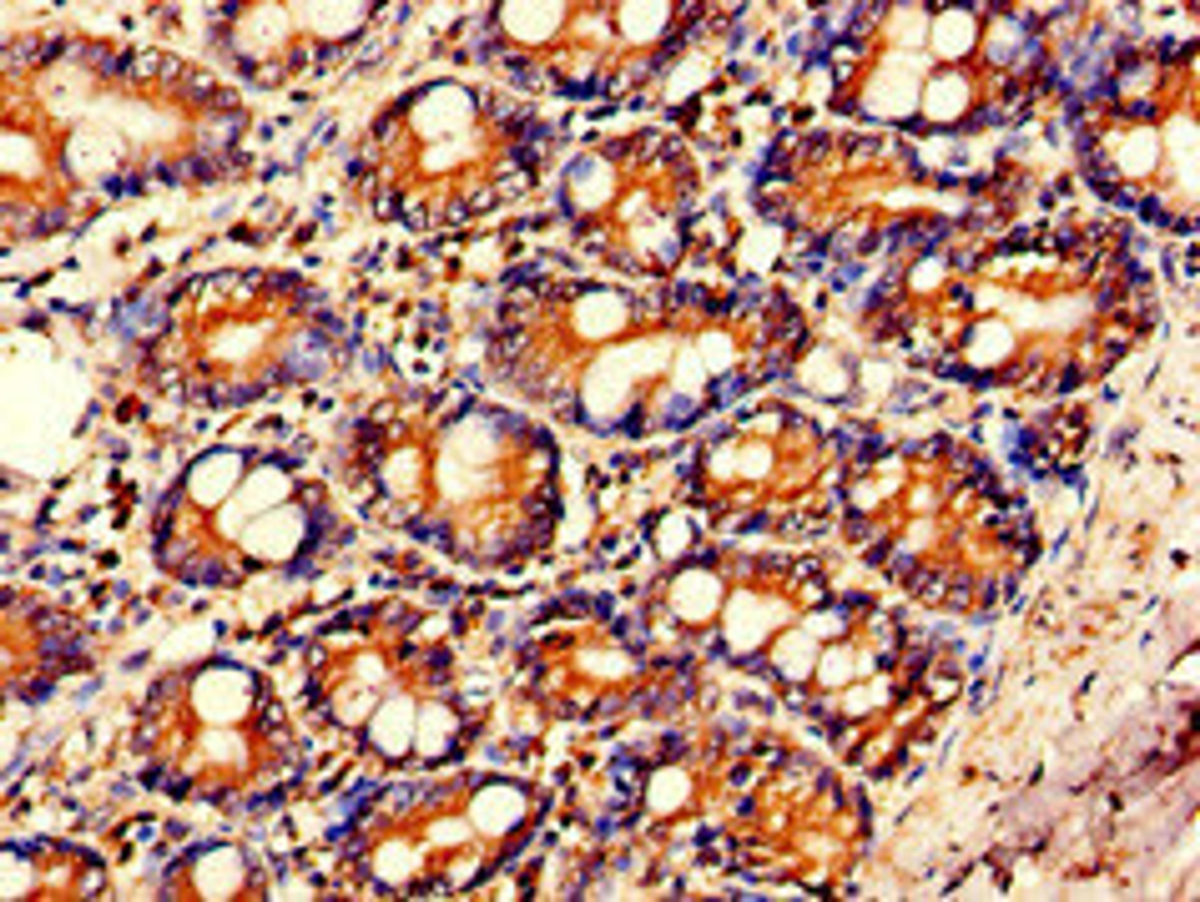 Immunohistochemistry of paraffin-embedded human small intestine tissue using CSB-PA06719A0Rb at dilution of 1:100