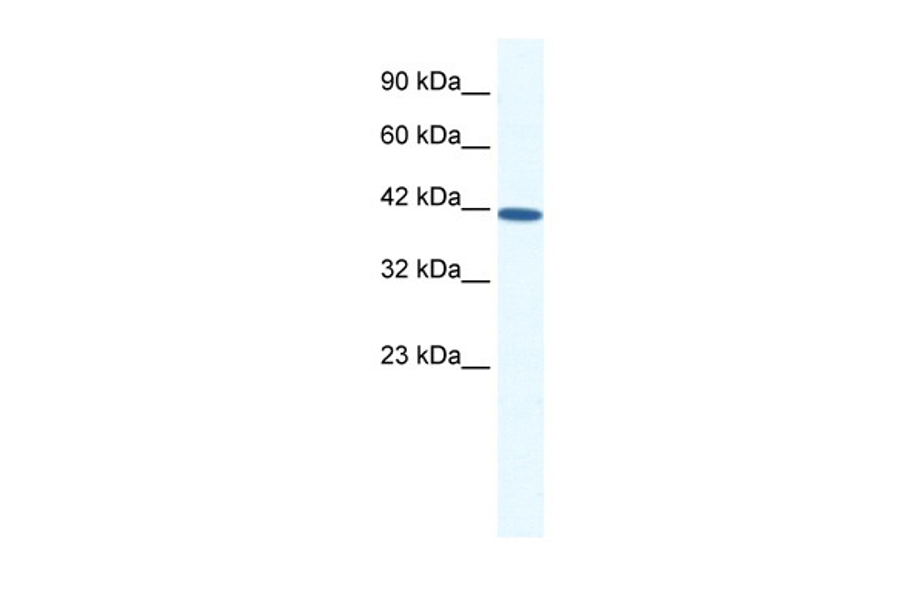 Antibody used in WB on Human HepG2 at 0.2-1 ug/ml.