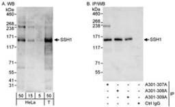 Detection of human SSH1 by western blot and immunoprecipitation.