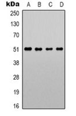 Western blot analysis of LOVO (Lane 1), Jurkat (Lane 2), NIH3T3 (Lane 3), PC12 (Lane 4) whole cell lysates using Alpha-1A Adrenergic Receptor antibody