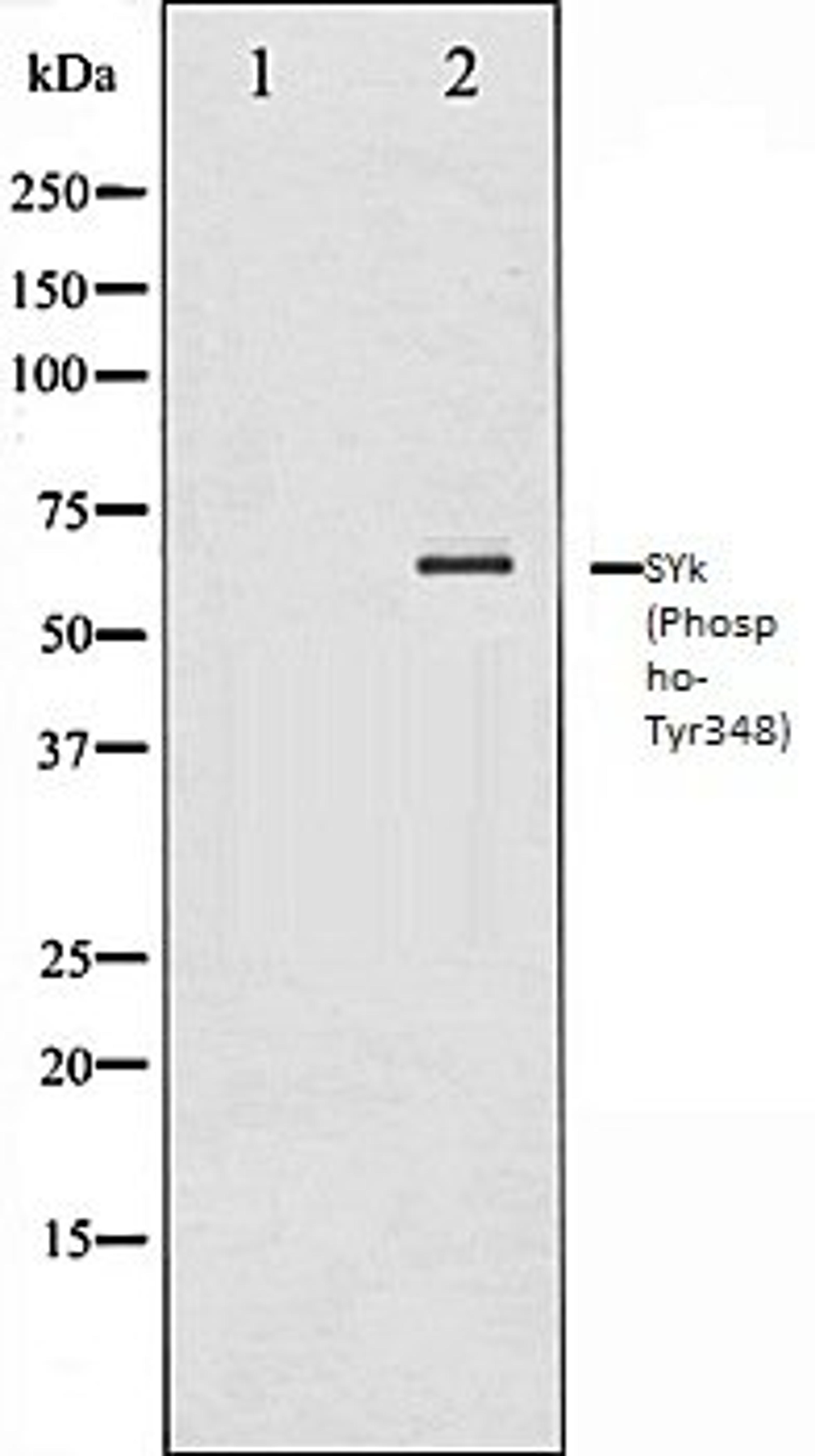 Western blot analysis of COS7 whole cell lysates using SYK (Phospho-Tyr348) antibody, The lane on the left is treated with the antigen-specific peptide.