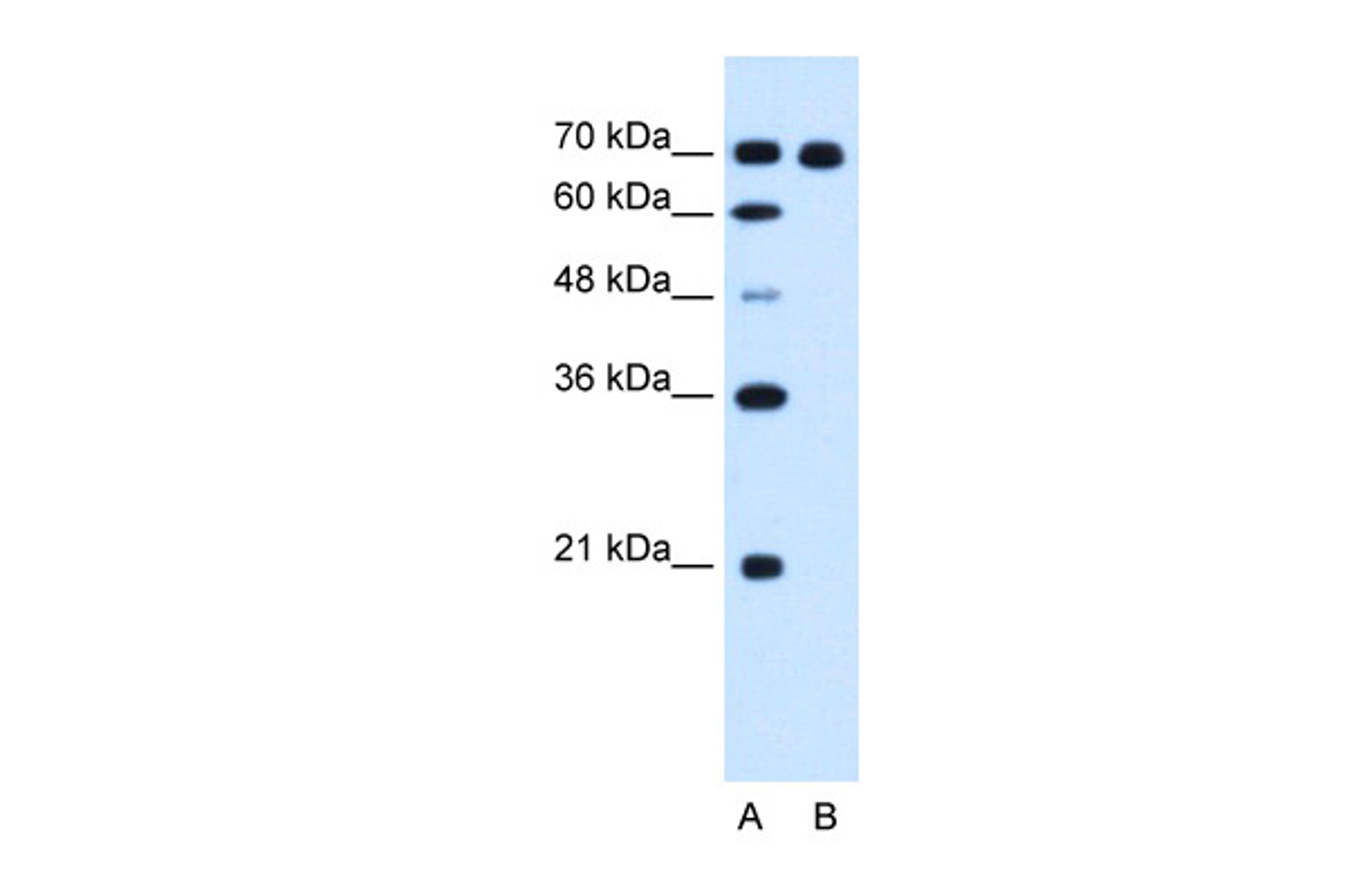 Antibody used in WB on Human HepG2 at 1.25 ug/ml.