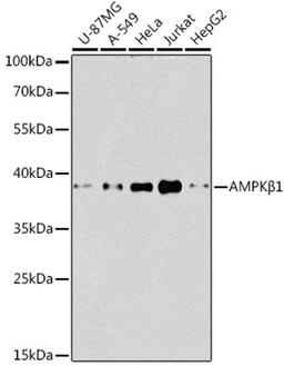 Western blot - AMPKß1 antibody (A12491)