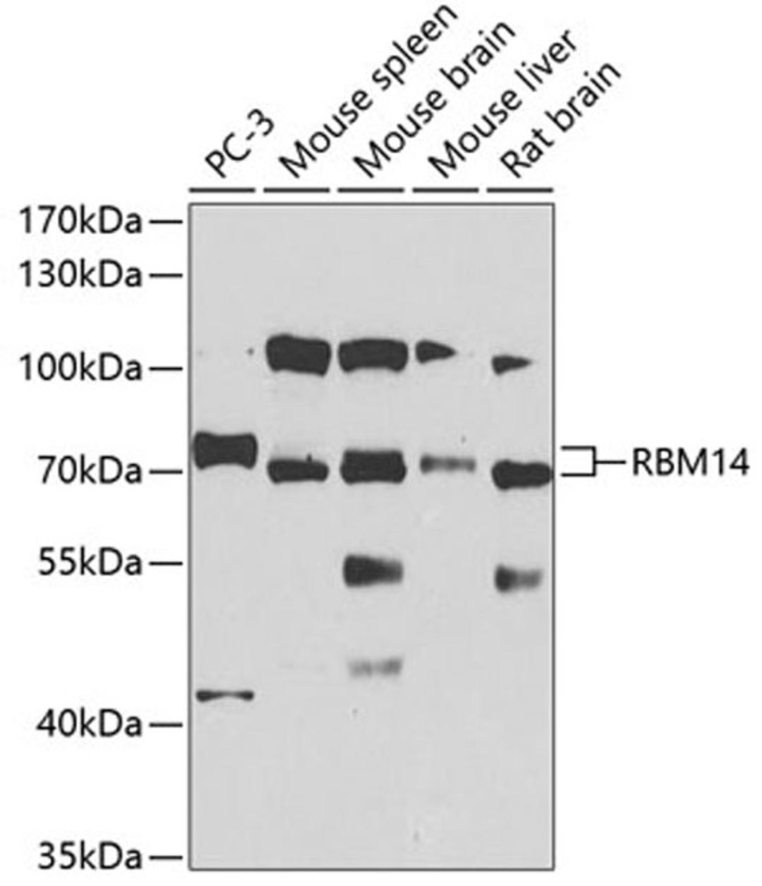 Western blot - RBM14 antibody (A4418)