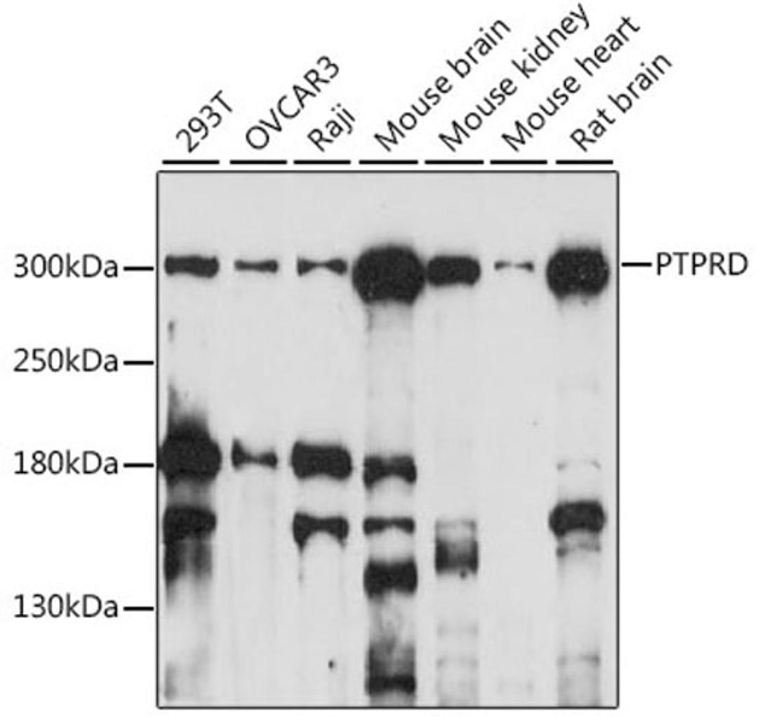 Western blot - PTPRD antibody (A15713)