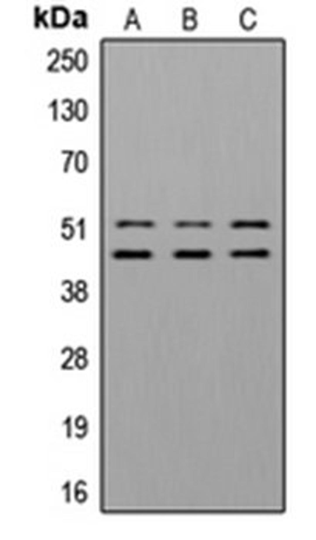 Western blot analysis of A549 insulin-treated (Lane 1), NIH3T3 insulin-treated (Lane 2) whole cell lysates using GSK3A; GSK3B antibody