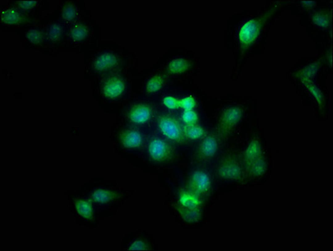 Immunofluorescence staining of Hela cells with CSB-PA002458EA01HU at 1:166, counter-stained with DAPI. The cells were fixed in 4% formaldehyde, permeabilized using 0.2% Triton X-100 and blocked in 10% normal Goat Serum. The cells were then incubated with the antibody overnight at 4°C. The secondary antibody was Alexa Fluor 488-congugated AffiniPure Goat Anti-Rabbit IgG(H+L).