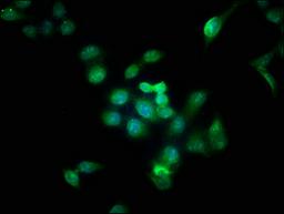 Immunofluorescence staining of Hela cells with CSB-PA002458EA01HU at 1:166, counter-stained with DAPI. The cells were fixed in 4% formaldehyde, permeabilized using 0.2% Triton X-100 and blocked in 10% normal Goat Serum. The cells were then incubated with the antibody overnight at 4°C. The secondary antibody was Alexa Fluor 488-congugated AffiniPure Goat Anti-Rabbit IgG(H+L).