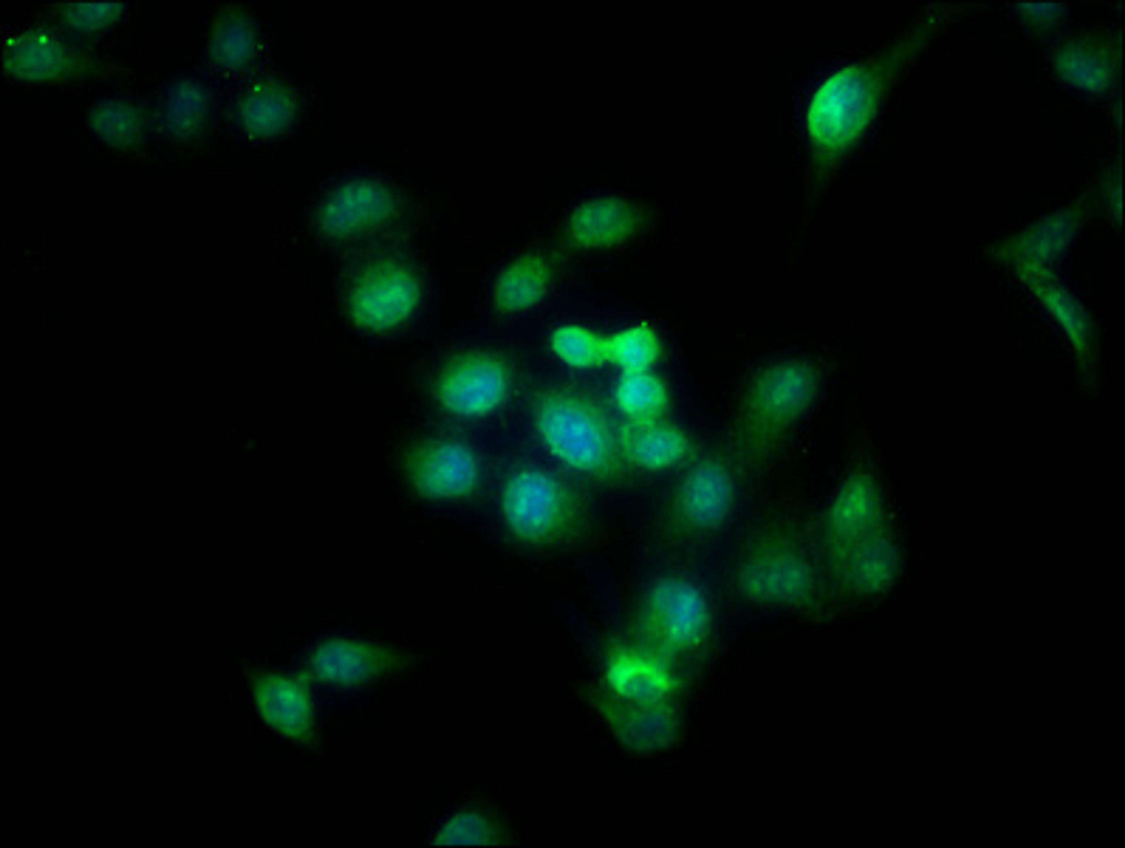 Immunofluorescence staining of Hela cells with CSB-PA002458EA01HU at 1:166, counter-stained with DAPI. The cells were fixed in 4% formaldehyde, permeabilized using 0.2% Triton X-100 and blocked in 10% normal Goat Serum. The cells were then incubated with the antibody overnight at 4°C. The secondary antibody was Alexa Fluor 488-congugated AffiniPure Goat Anti-Rabbit IgG(H+L).