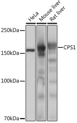 Western blot - CPS1 Rabbit mAb (A4214)