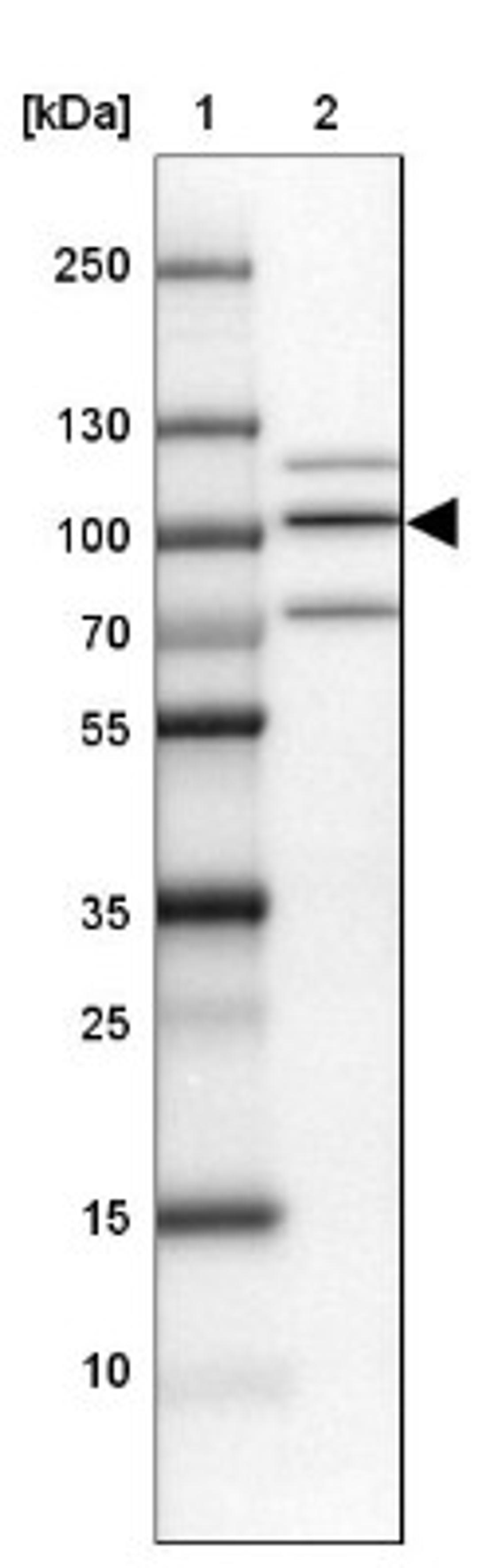 Western Blot: PIMT Antibody [NBP1-92271] - Lane 1: Marker [kDa] 250, 130, 100, 70, 55, 35, 25, 15, 10<br/>Lane 2: NTERA-2 Medium