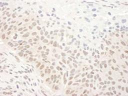 Detection of human DHX33 by immunohistochemistry.