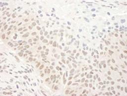 Detection of human DHX33 by immunohistochemistry.