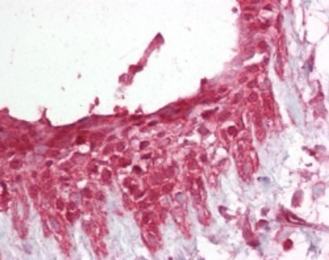 Immunohistochemistry-Paraffin: Pellino 1 Antibody [NB100-56672] - Analysis of human breast using Pellino 1 antibody at 1:100.