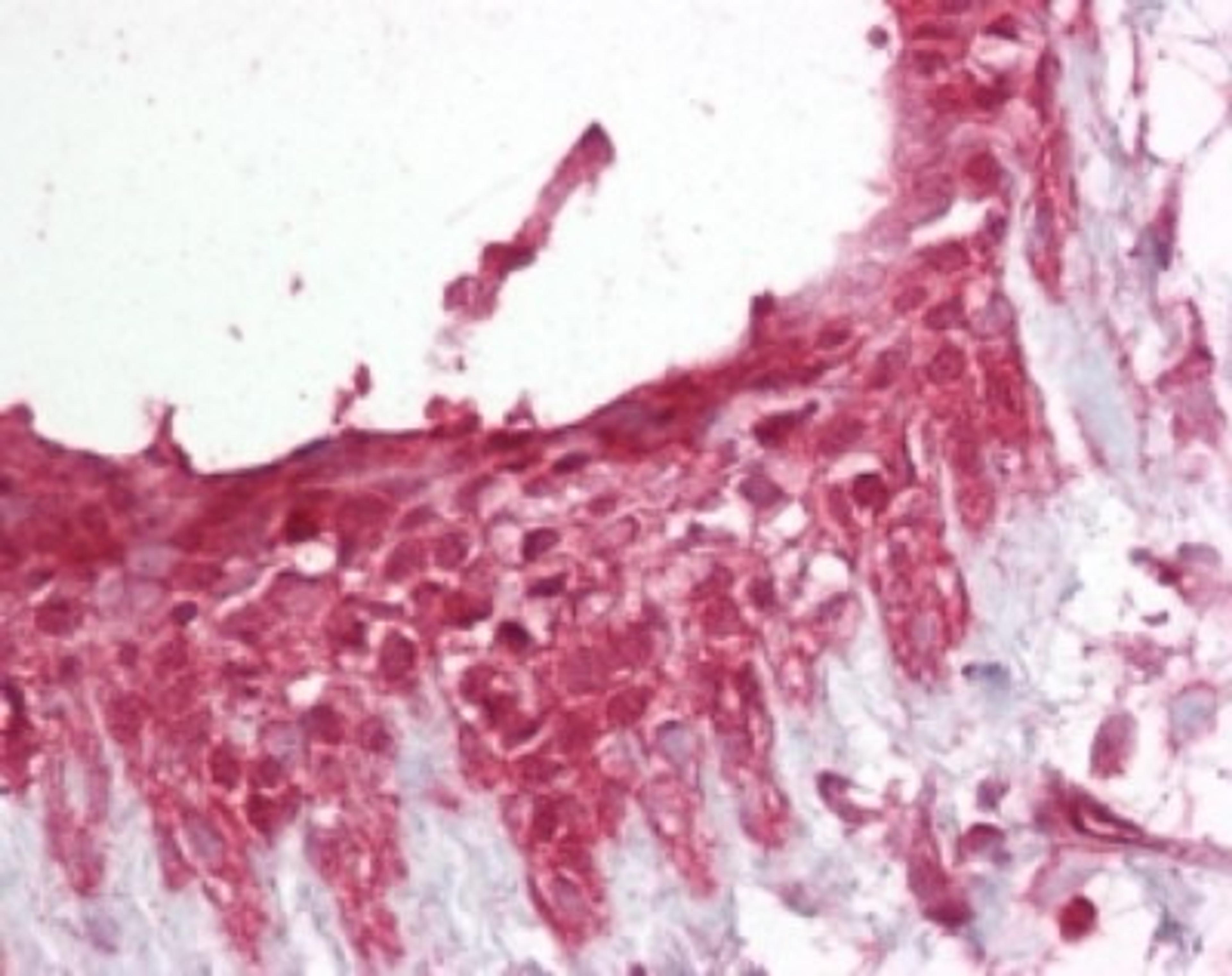 Immunohistochemistry-Paraffin: Pellino 1 Antibody [NB100-56672] - Analysis of human breast using Pellino 1 antibody at 1:100.