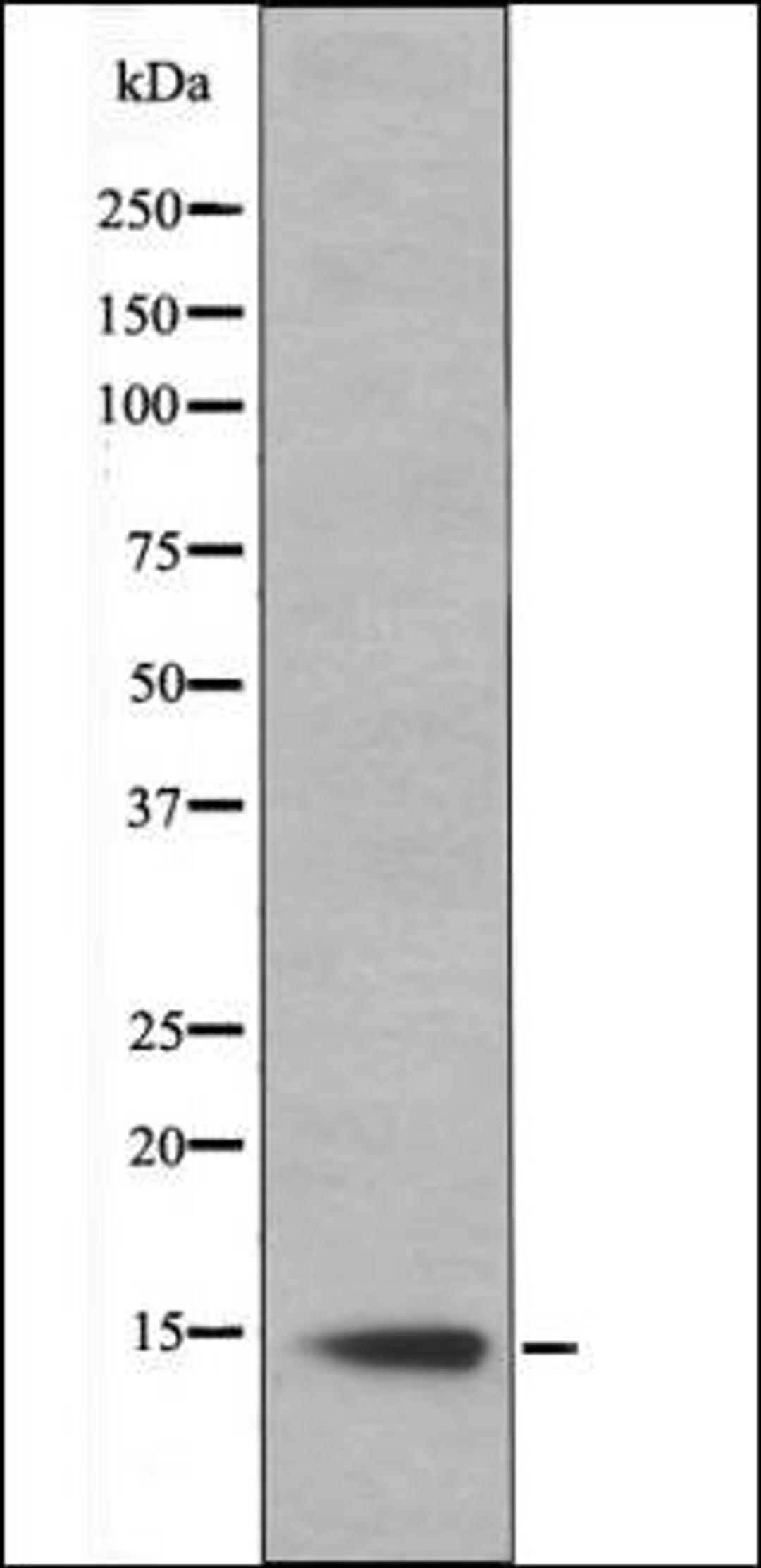 Western blot analysis of Hela whole cell lysates using Histone H2B -Phospho-Ser14- antibody