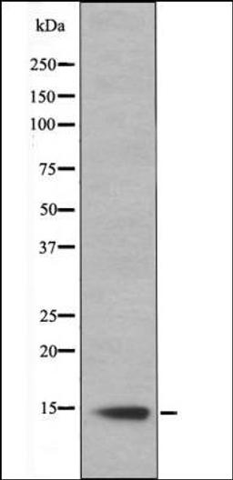 Western blot analysis of Hela whole cell lysates using Histone H2B -Phospho-Ser14- antibody