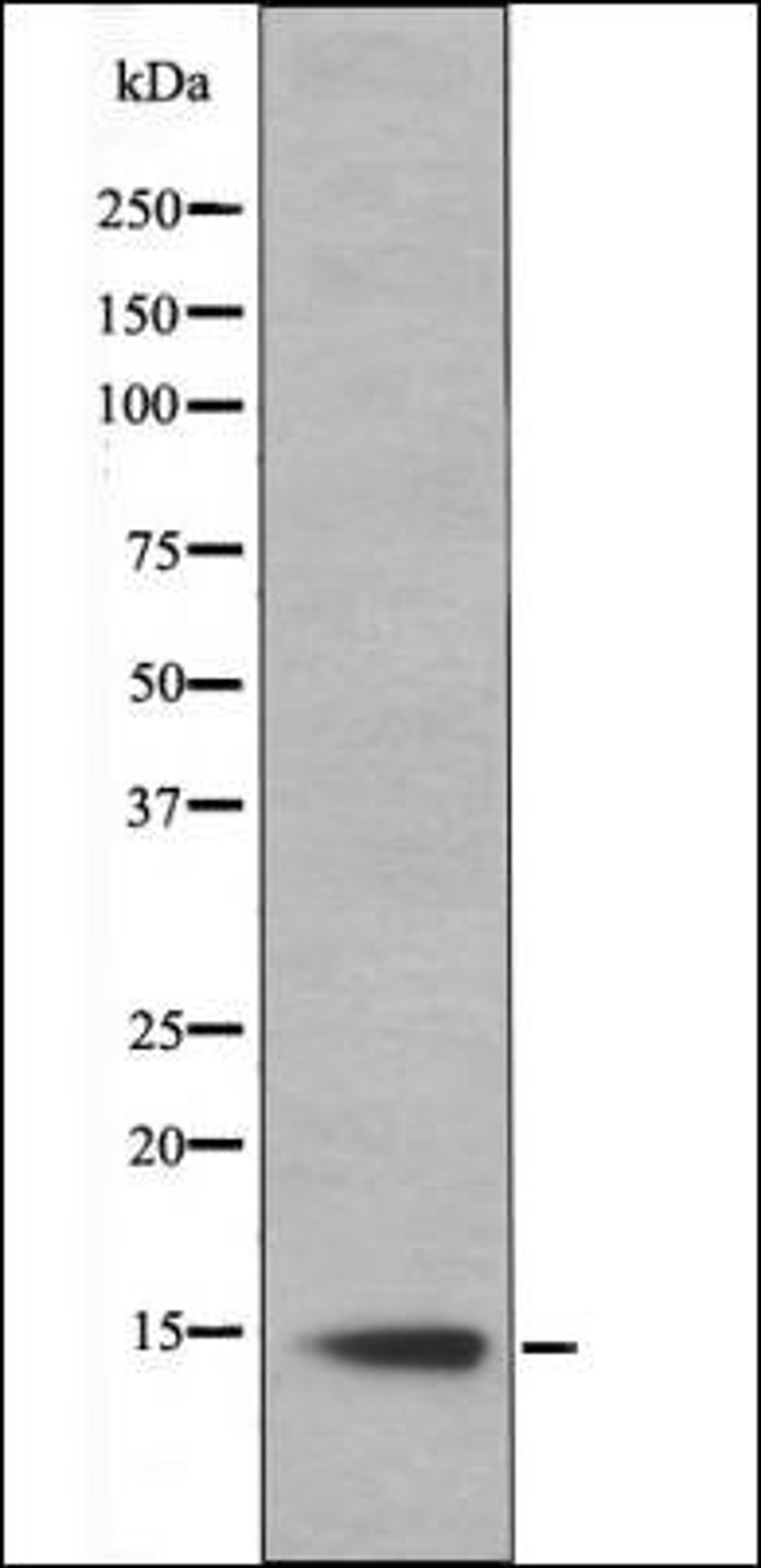 Western blot analysis of Hela whole cell lysates using Histone H2B -Phospho-Ser14- antibody