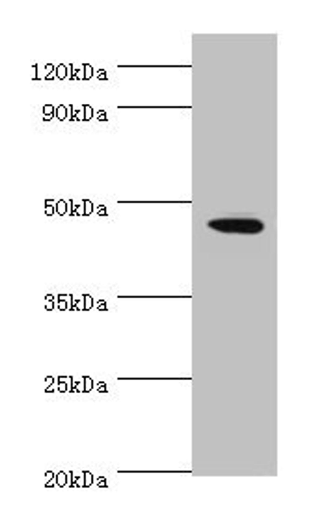 Western blot. All lanes: STK32A antibody at 2µg/ml + MCF-7 whole cell lysate. Secondary. Goat polyclonal to rabbit IgG at 1/10000 dilution. Predicted band size: 47, 20, 42 kDa. Observed band size: 47 kDa