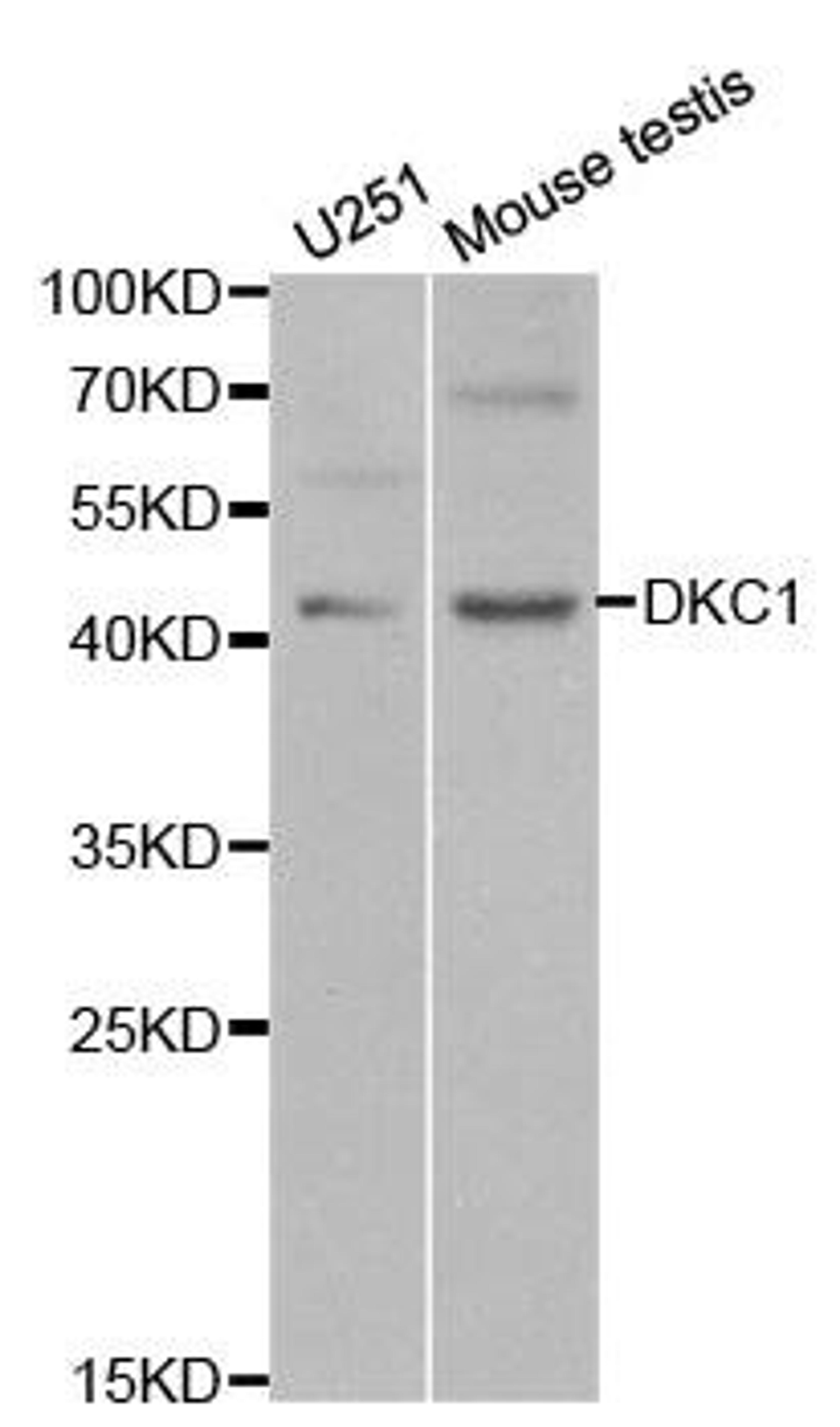 Western blot analysis of extracts of various cell lines using DKC1 antibody