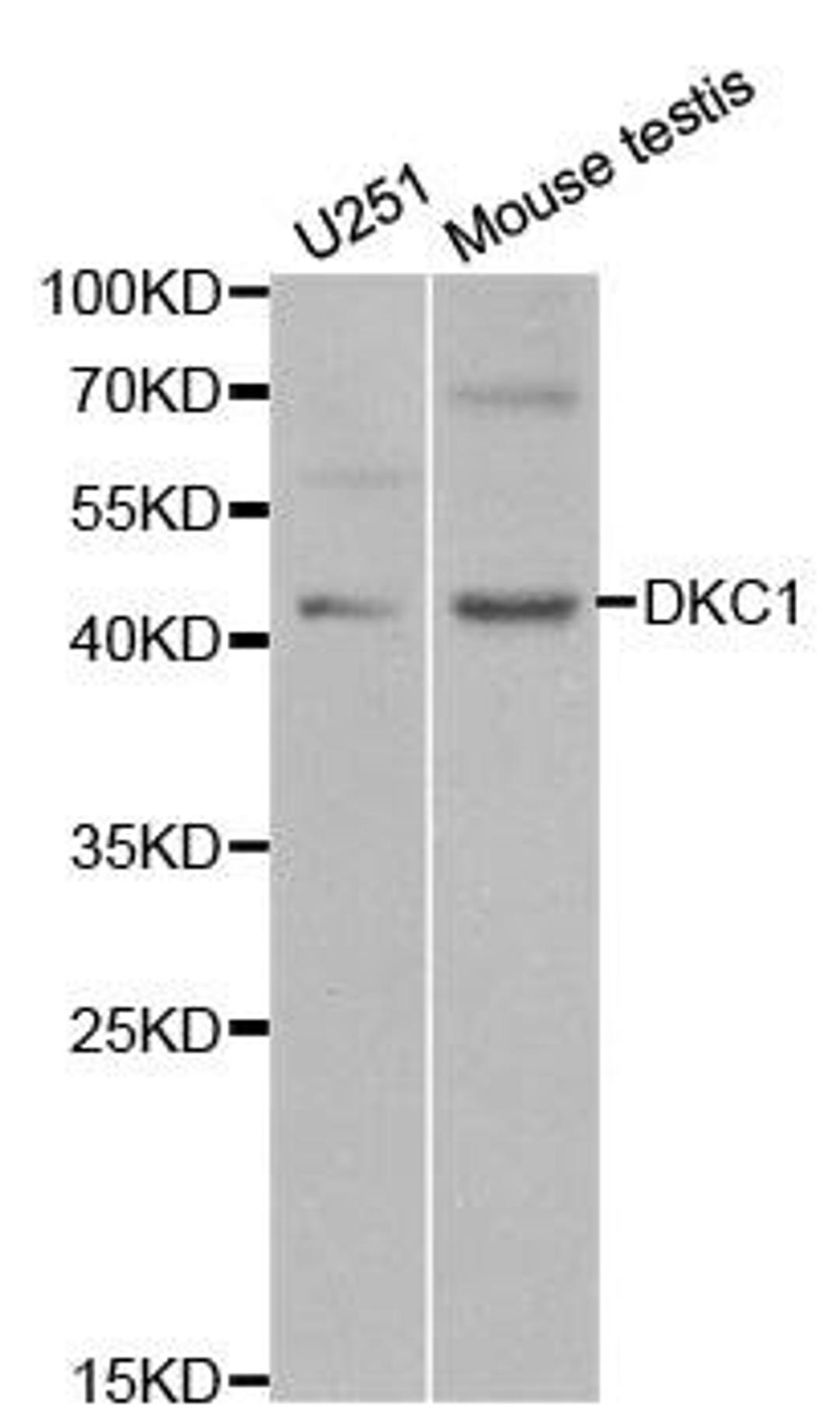 Western blot analysis of extracts of various cell lines using DKC1 antibody