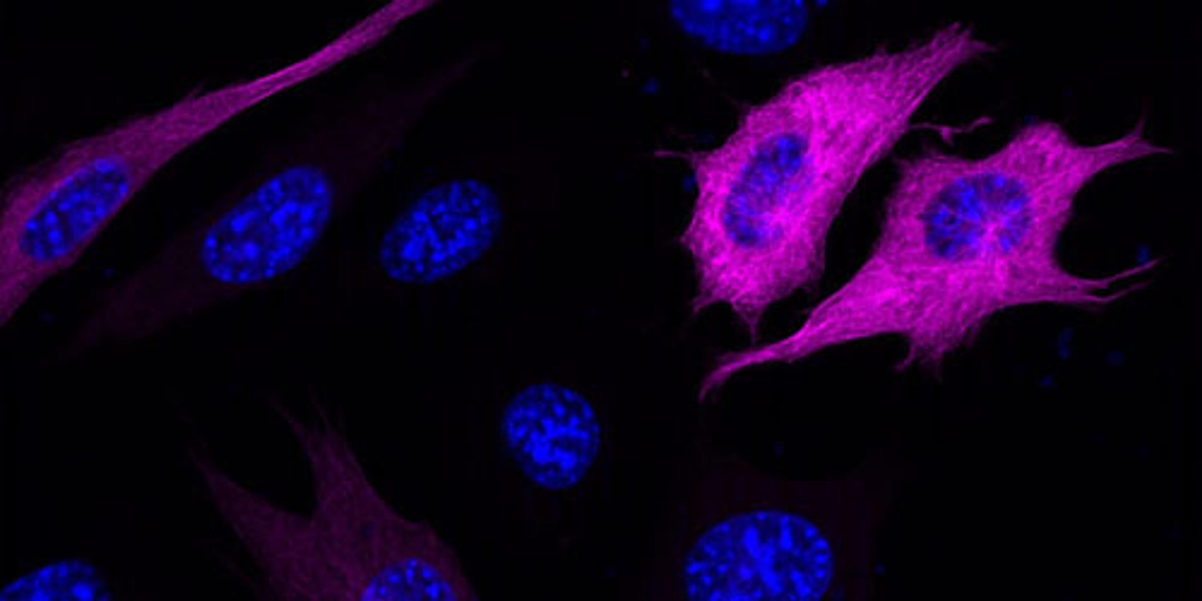 3T3 cells expressing mCherry-Tubulin were stained with protag-HiRes anti-RFP-X4 Abberior® Star 635P (magenta, Cat. No. 82404). Nuclei were stained using DAPI (blue)(courtesy of NanoTag Biotechnologies GmbH).