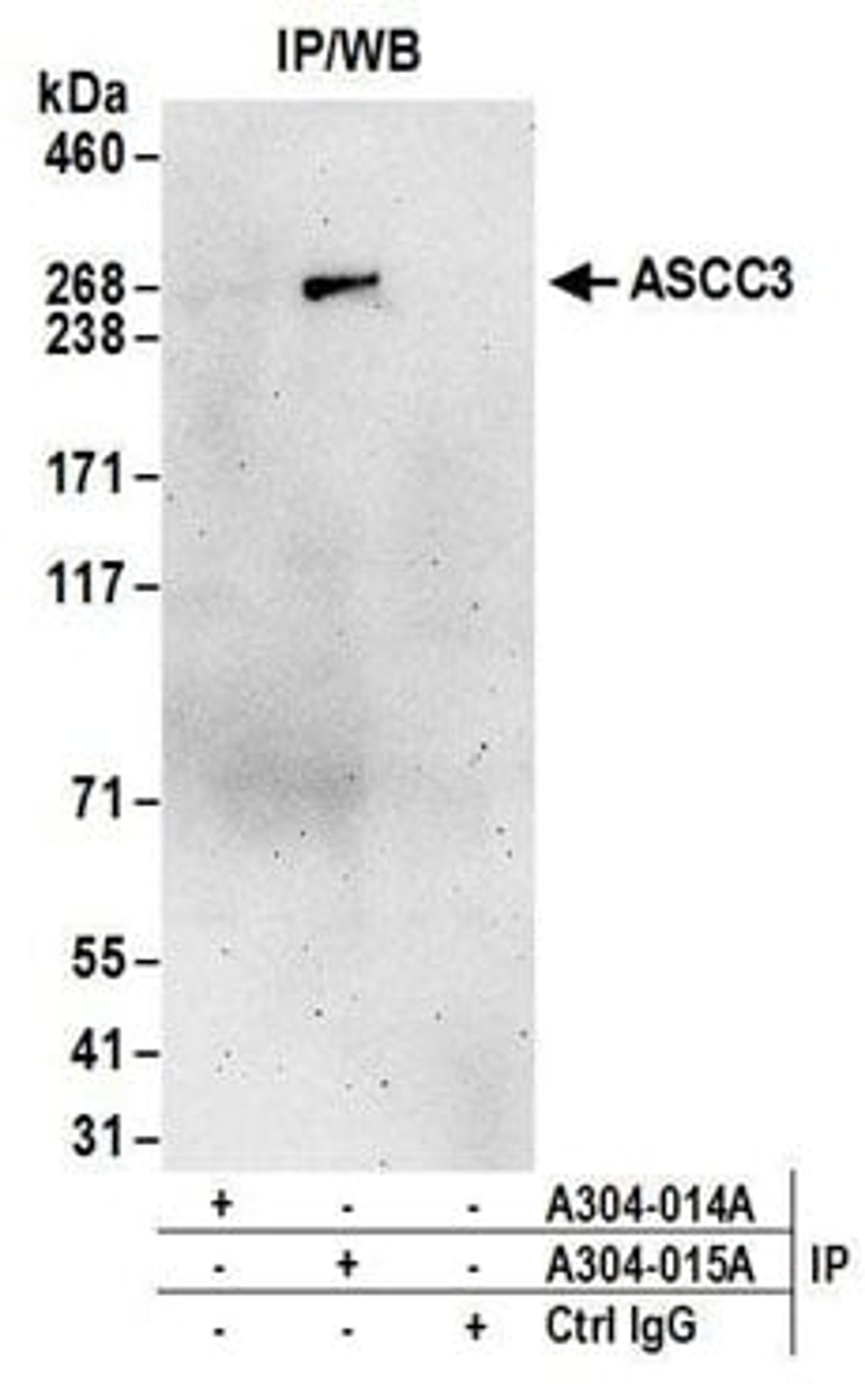 Detection of human ASCC3 by western blot of immunoprecipitates.