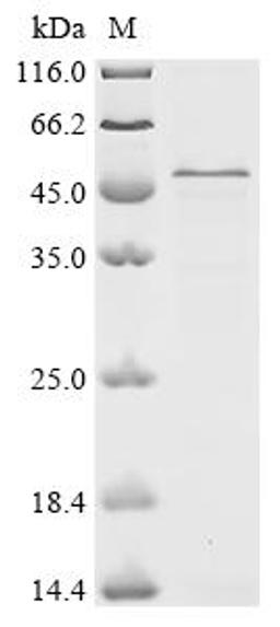(Tris-Glycine gel) Discontinuous SDS-PAGE (reduced) with 5% enrichment gel and 15% separation gel.