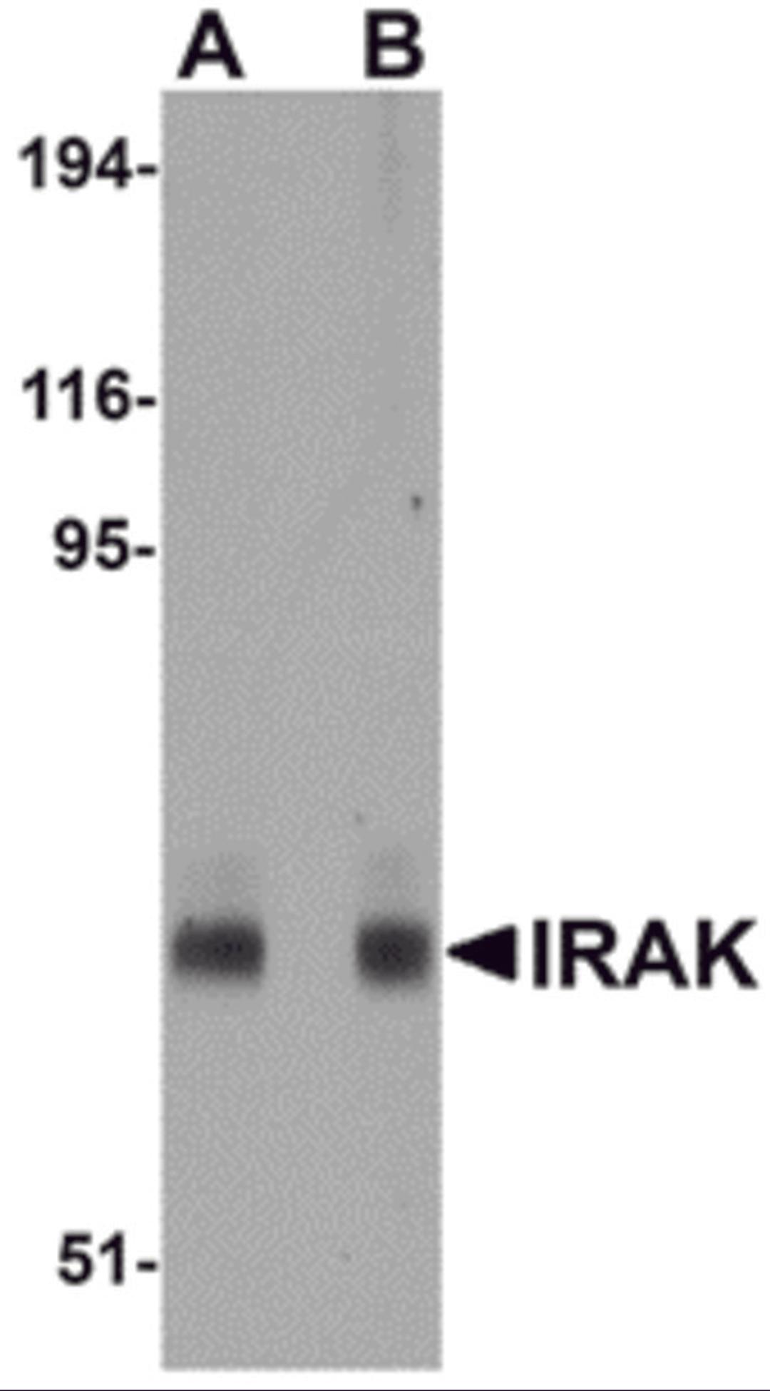 Western blot analysis of IRAK in mouse liver lysate with IRAK antibody at (A) 1 and (B) 2 μg/mL.