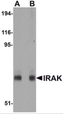 Western blot analysis of IRAK in mouse liver lysate with IRAK antibody at (A) 1 and (B) 2 μg/mL.