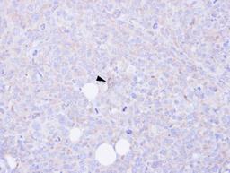 Immunohistochemistry-Paraffin: CARD9 Antibody [NBP1-32982] - Paraffin-embedded H1299 xenograft, using antibody at 1:100 dilution.