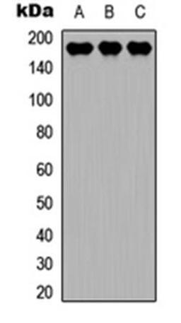 Western blot analysis of A549 (Lane1), Raw264.7 (Lane2), PC12 (Lane3) whole cell using MEKK4 antibody