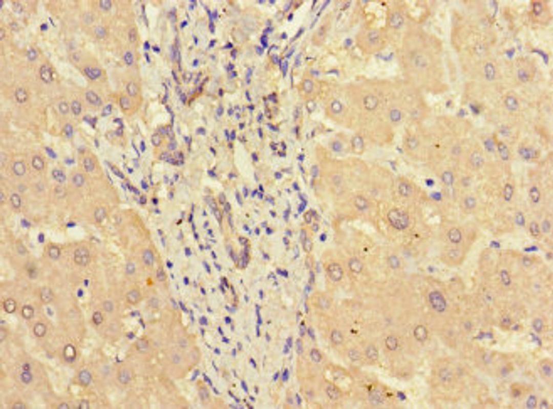 Immunohistochemistry of paraffin-embedded human liver tissue using CSB-PA022812LA01HU at dilution of 1:100