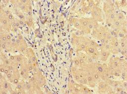 Immunohistochemistry of paraffin-embedded human liver tissue using CSB-PA022812LA01HU at dilution of 1:100