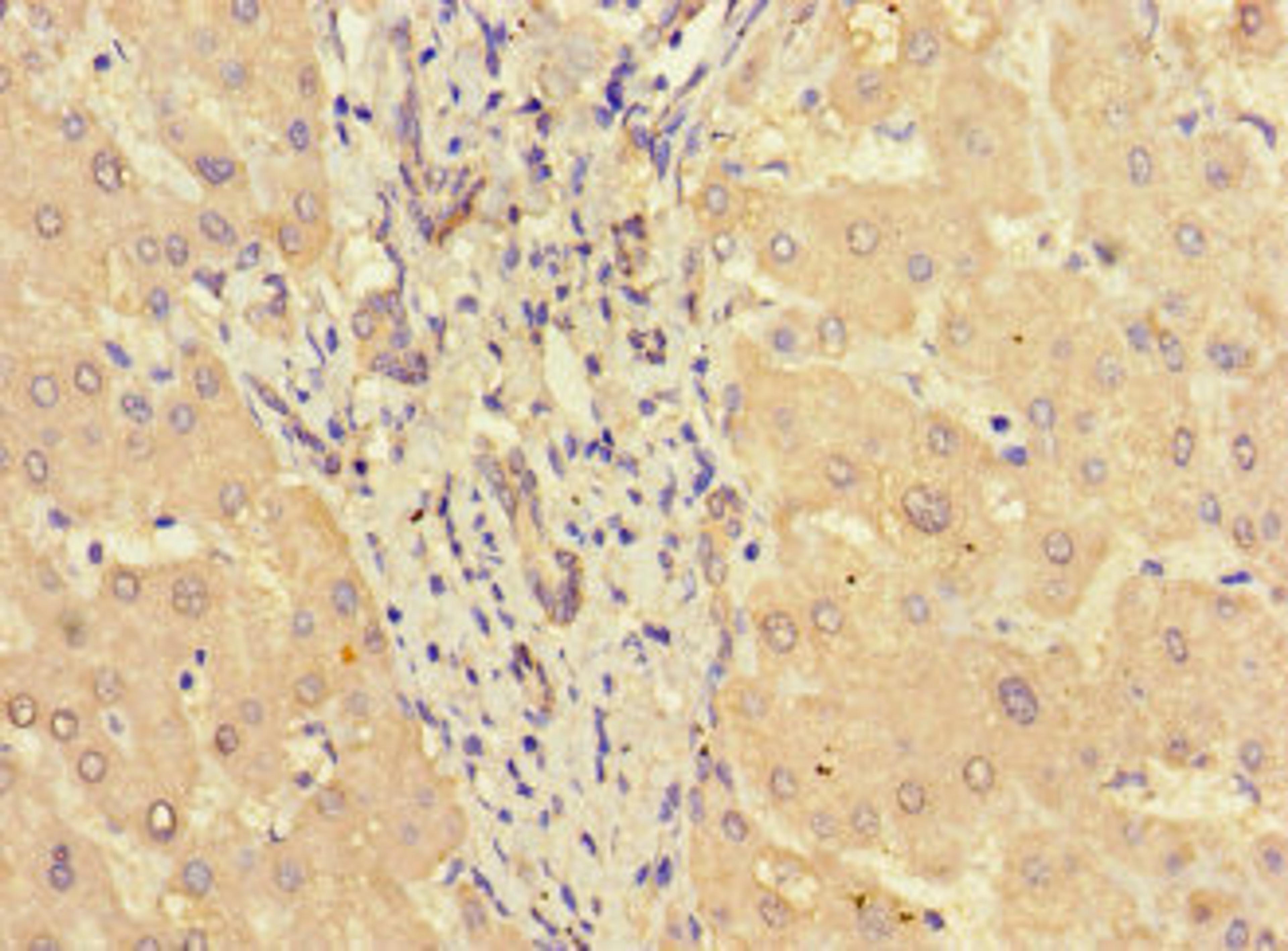 Immunohistochemistry of paraffin-embedded human liver tissue using CSB-PA022812LA01HU at dilution of 1:100
