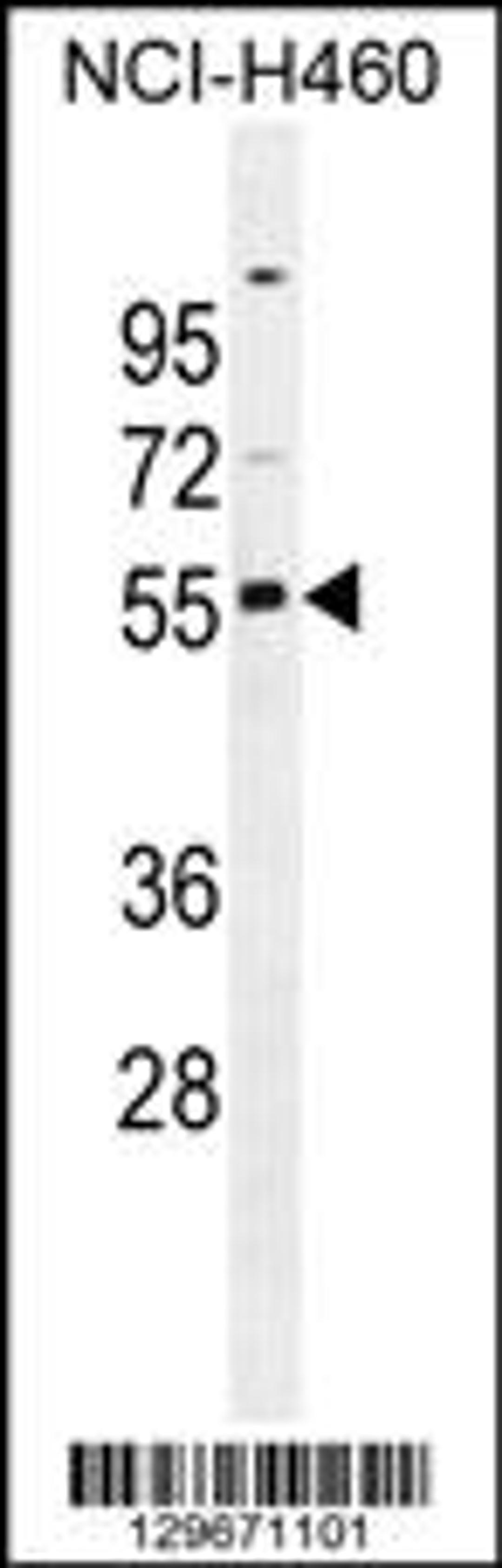 Western blot analysis in NCI-H460 cell line lysates (35ug/lane).