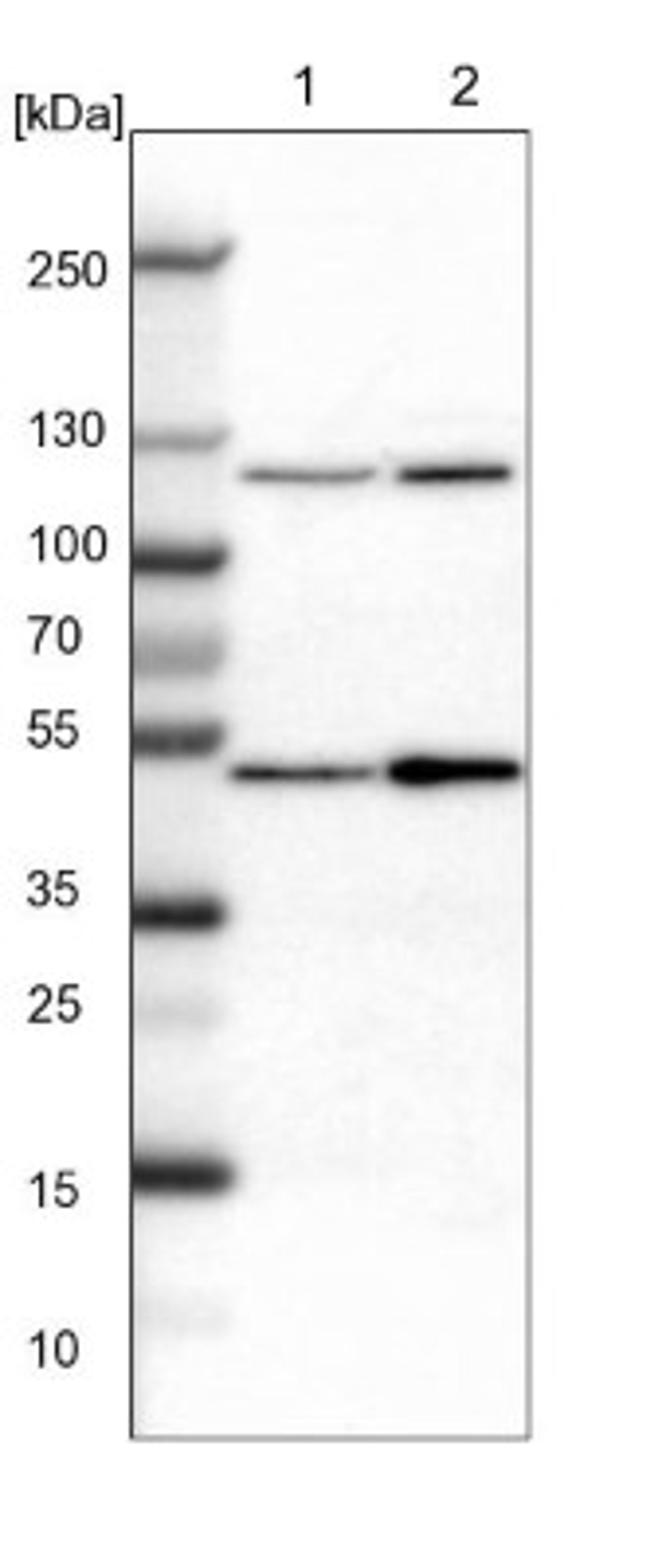 Western Blot: RNF215 Antibody [NBP1-92342] - Lane 1: NIH-3T3 cell lysate (Mouse embryonic fibroblast cells)<br/>Lane 2: NBT-II cell lysate (Rat Wistar bladder tumour cells)