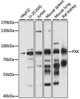 Western blot - PXK antibody (A15458)