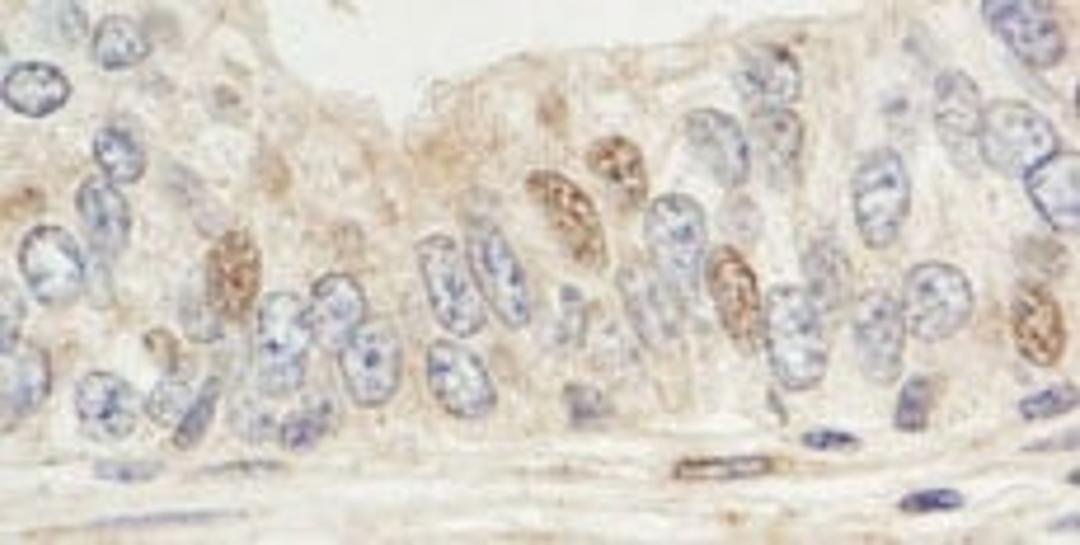 Detection of human Sin1 by immunohistochemistry.