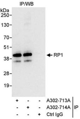 Detection of human RP1 by western blot of immunoprecipitates.