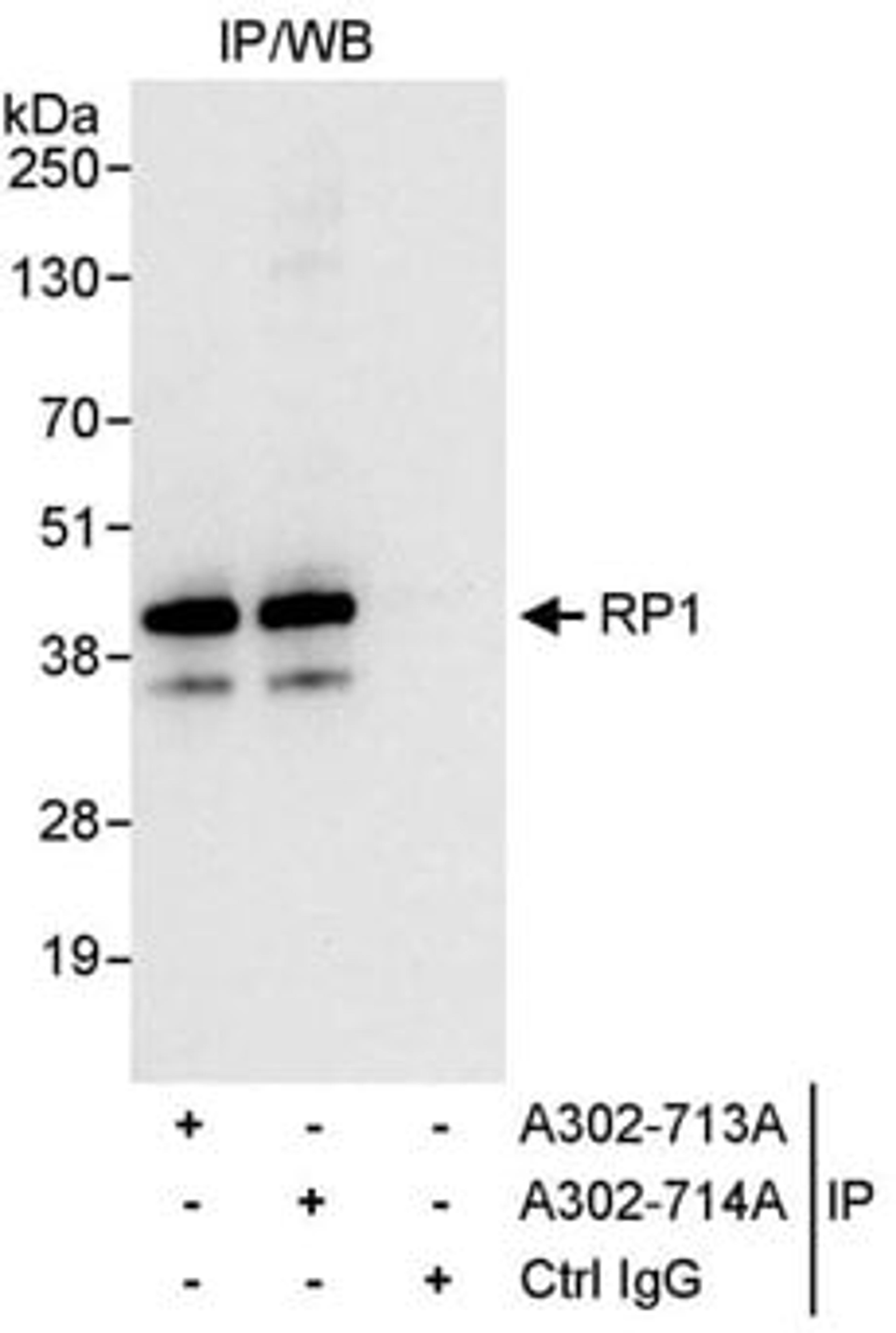 Detection of human RP1 by western blot of immunoprecipitates.