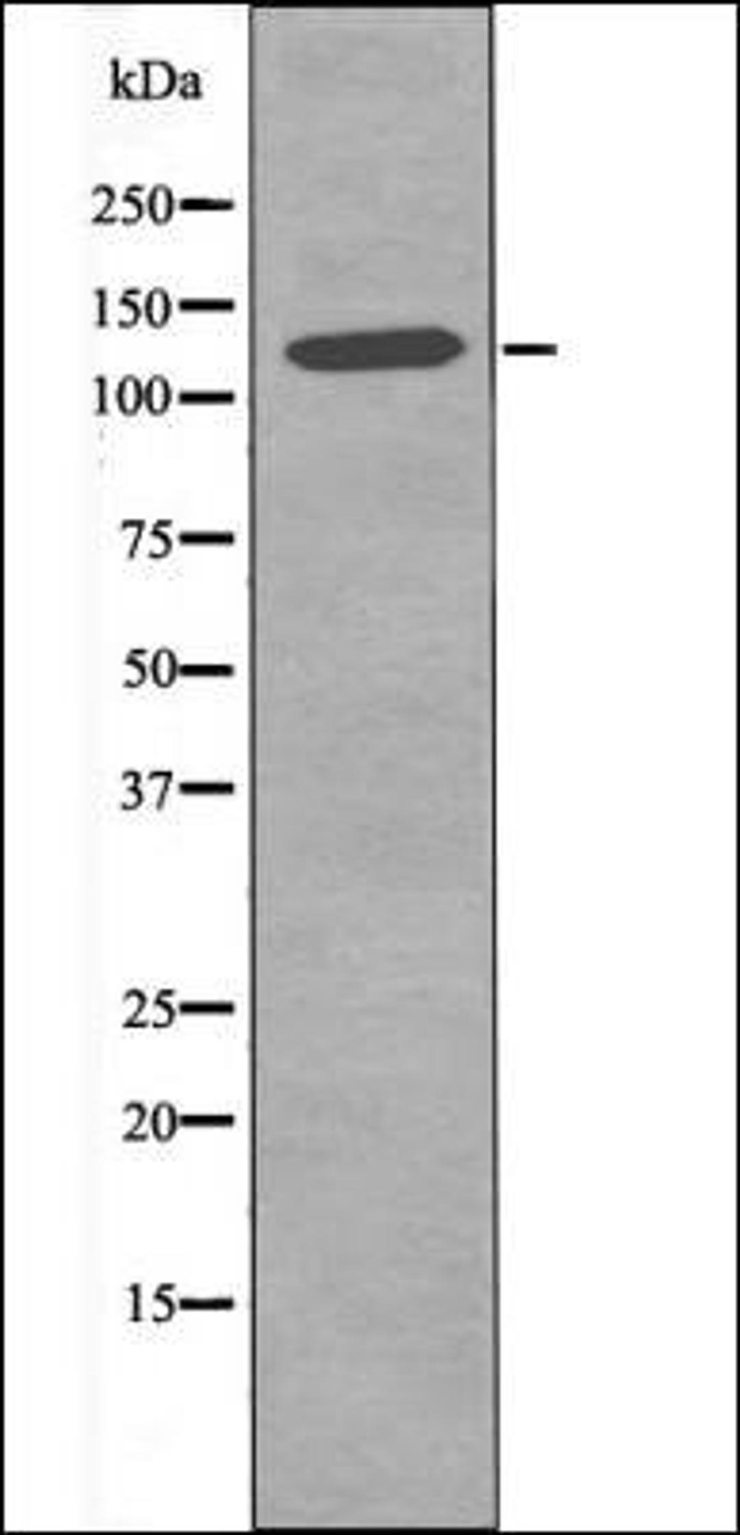 Western blot analysis of 293 whole cell lysates using JAK2 -Phospho-Tyr119- antibody