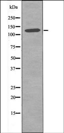 Western blot analysis of 293 whole cell lysates using JAK2 -Phospho-Tyr119- antibody