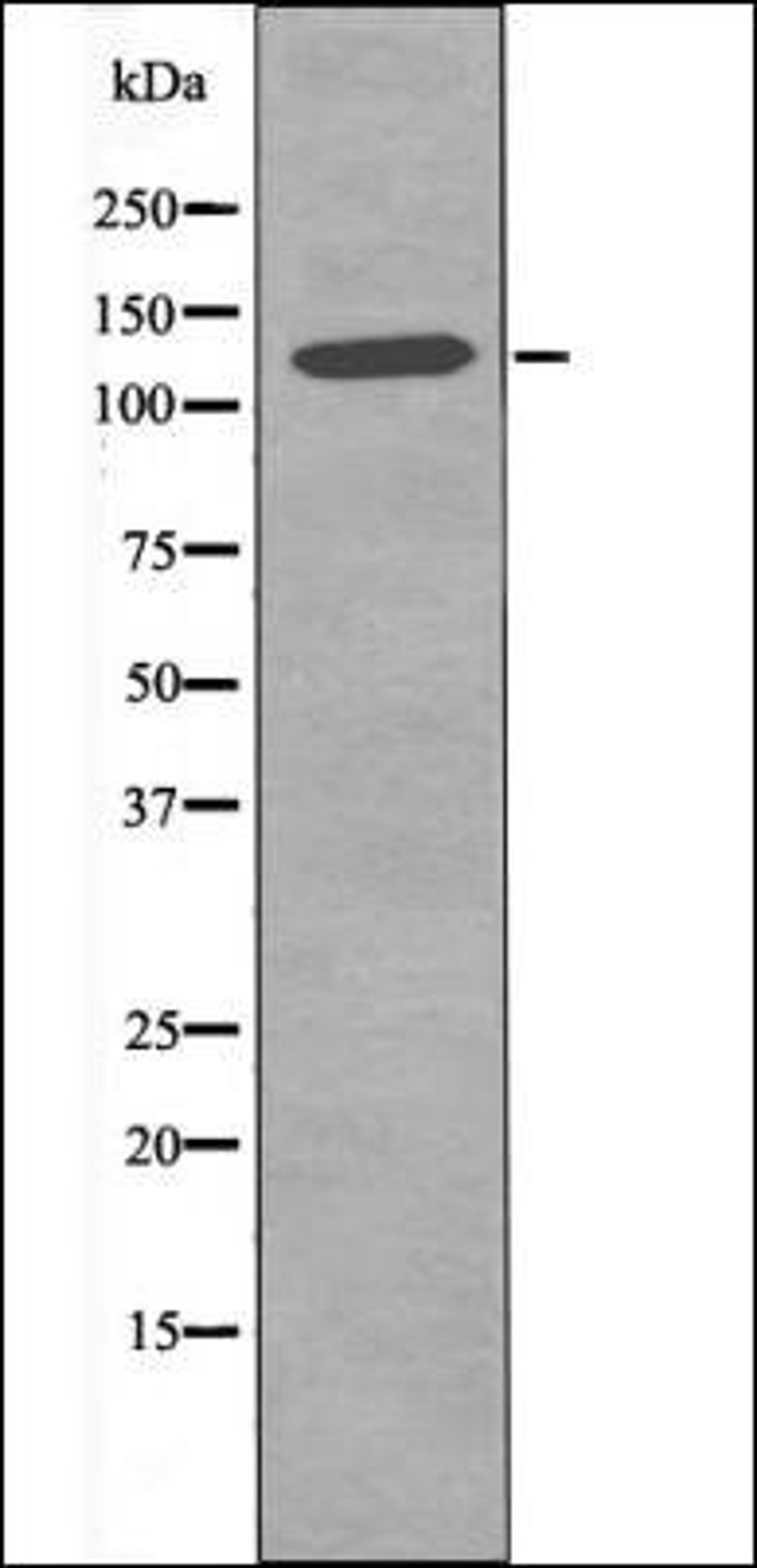 Western blot analysis of 293 whole cell lysates using JAK2 -Phospho-Tyr119- antibody