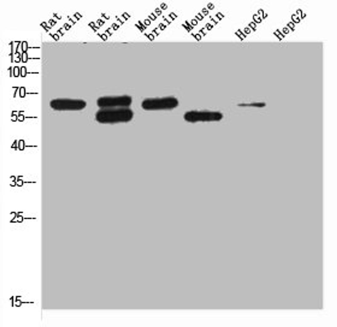 Western blot analysis of 1) Rat Brain Tissue-Low Molecular Protein Marker, 2)Rat Brain Tissue-High Molecular Protein Marker, 3) Mouse Brain Tissue-Low Molecular Protein Marker, 4) Mouse Brain Tissue- High Molecular Protein Marker, 5) HepG2-Low Molecular P